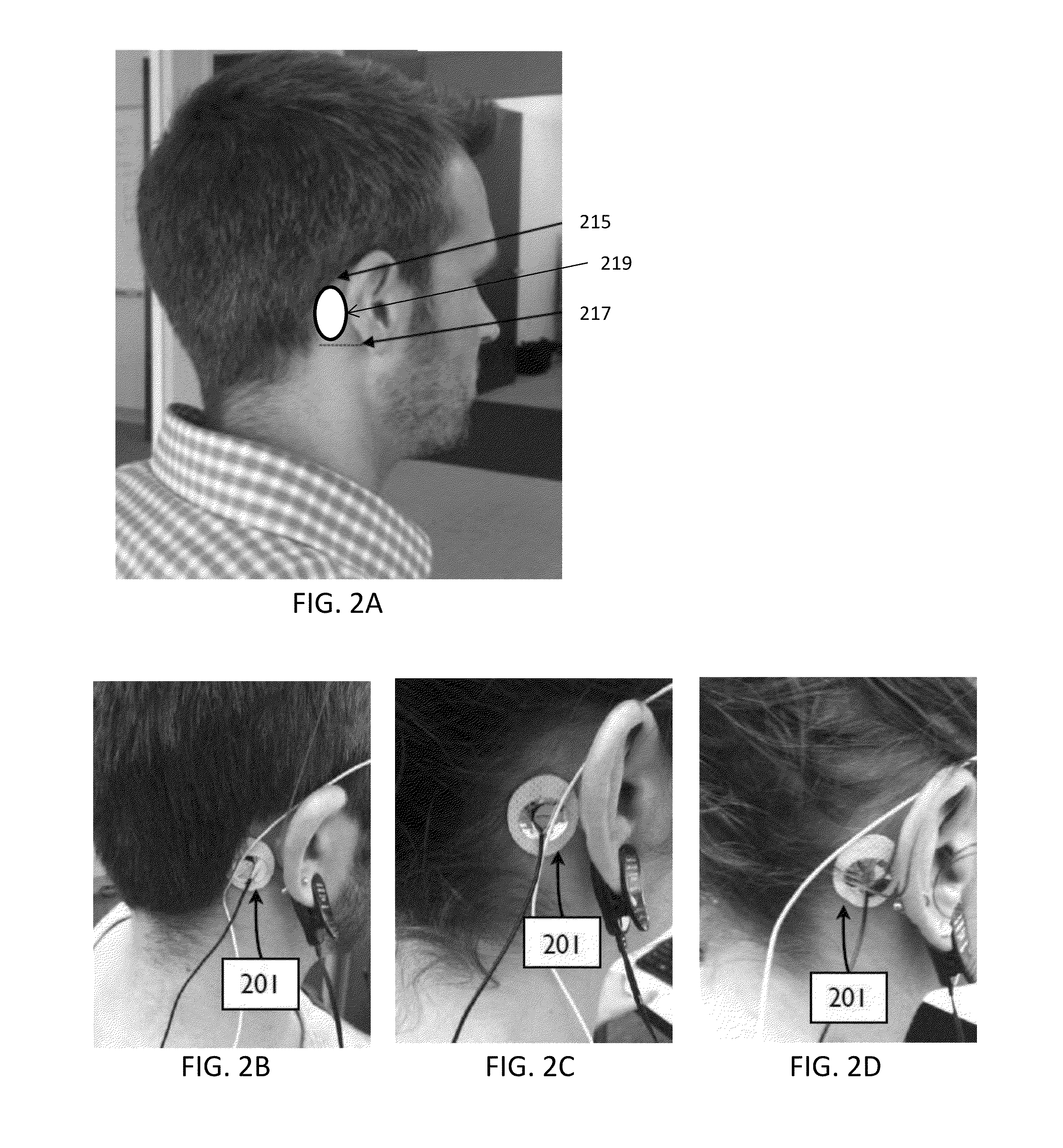 Transdermal electrical stimulation devices for modifying or inducing cognitive state