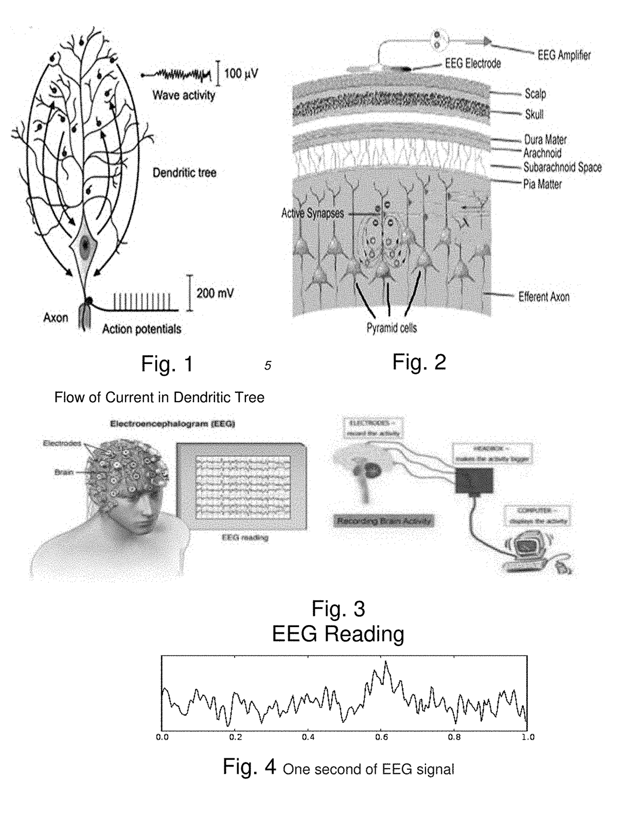 Method and apparatus for neuroenhancement