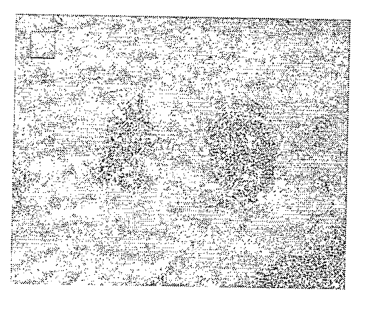 Human Liver Cancer Cell Line