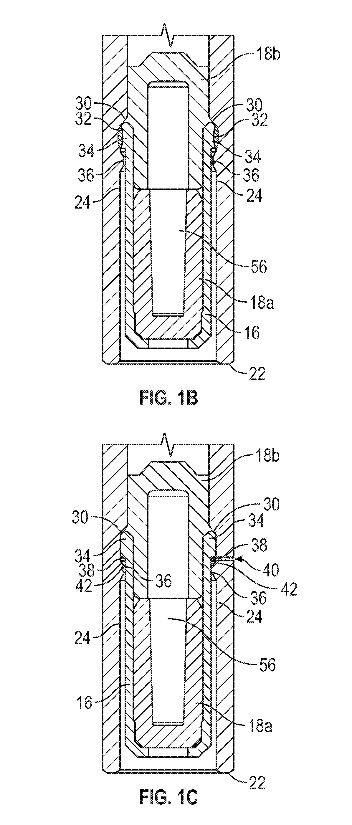 Septum housing