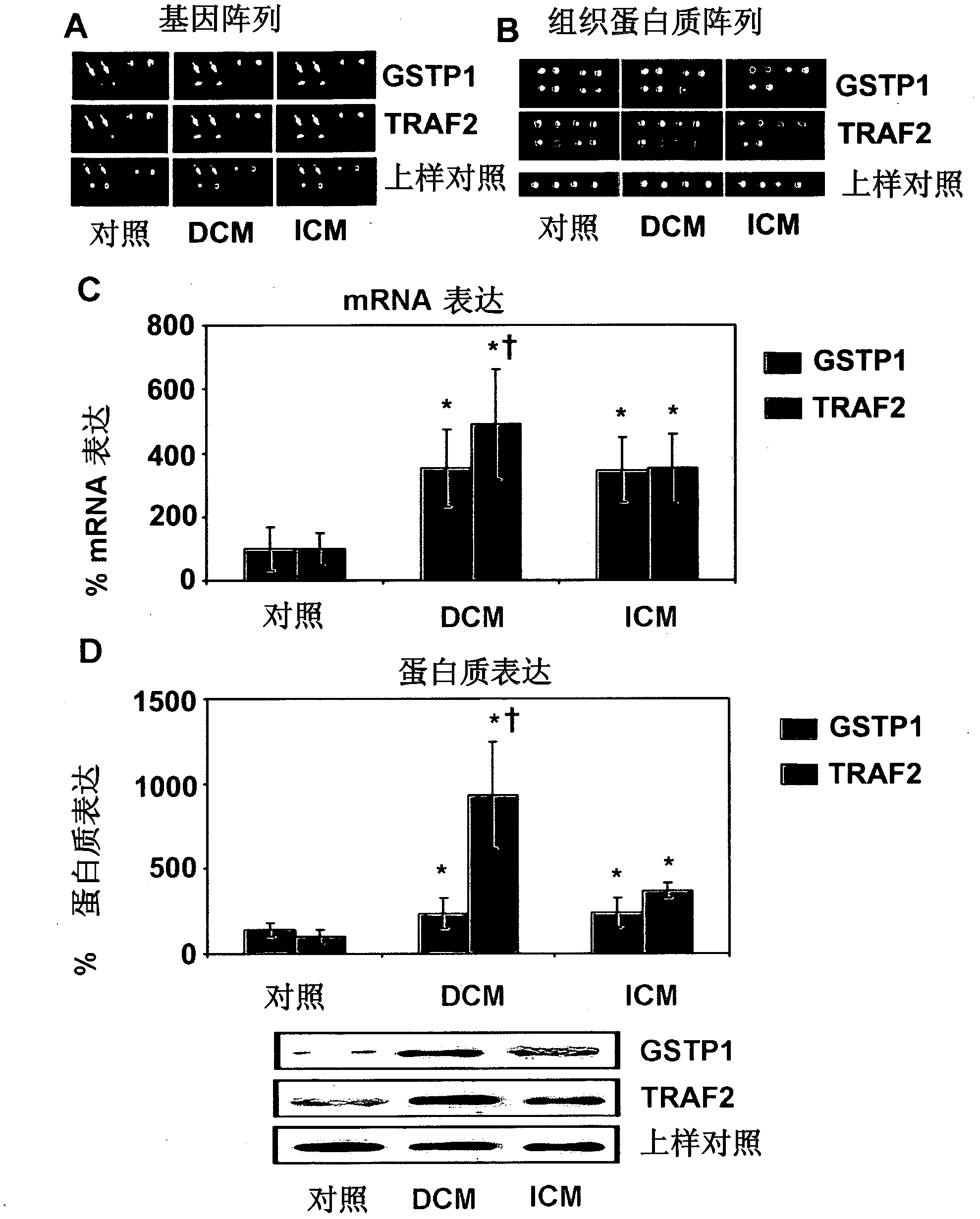 Use of GSTP1