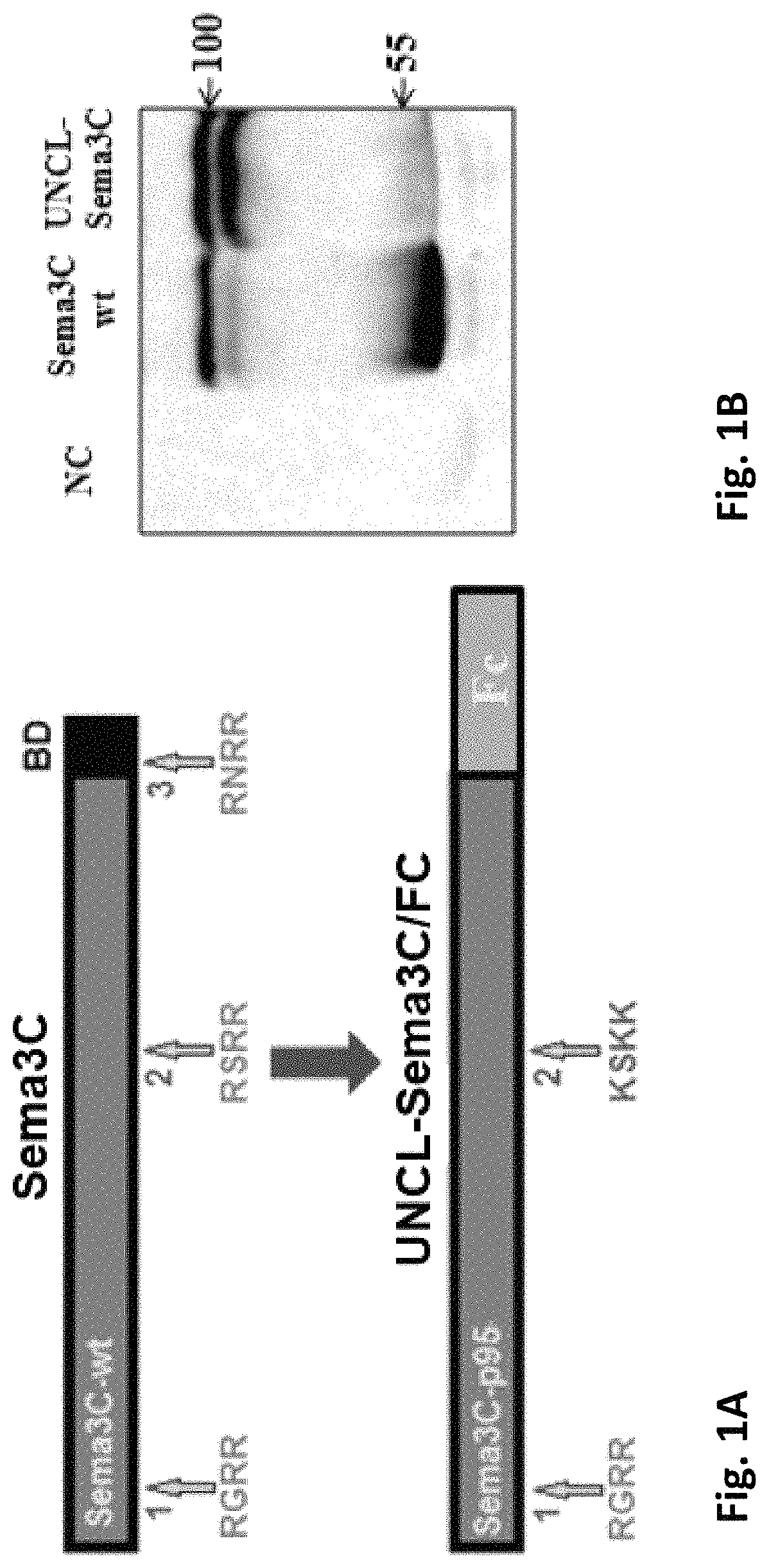 Semaphorin 3C variants, compositions comprising said variants and methods of use thereof in treating eye diseases