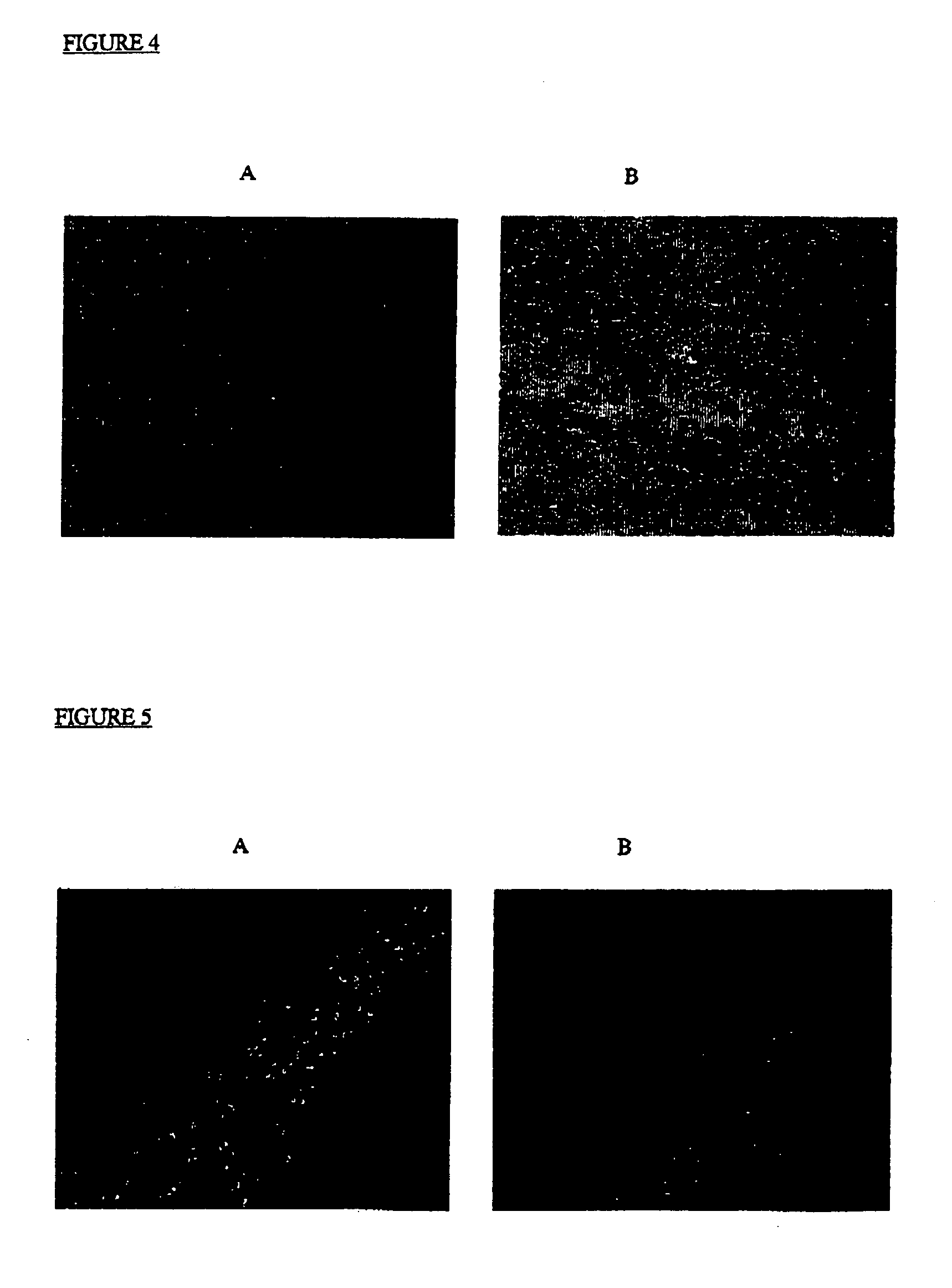 Therapeutic compositions and methods of treating glycolipid storage related disorders