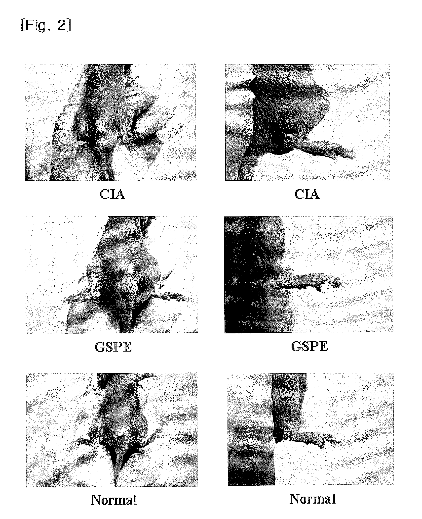 Process for preparing vitis vinifera pip extract and pharmaceutical composition for preventing or treating rheumatoid arthritis comprising the same