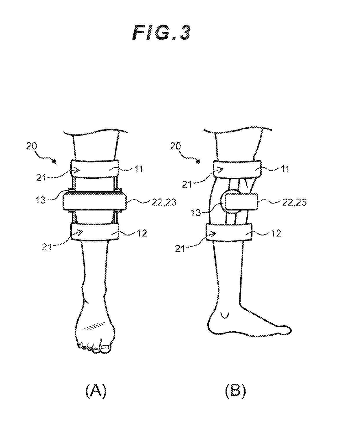 Knee joint orthotic device manufacturing apparatus and knee joint orthotic device manufacturing method, and knee joint treatment support apparatus and knee joint treatment support method
