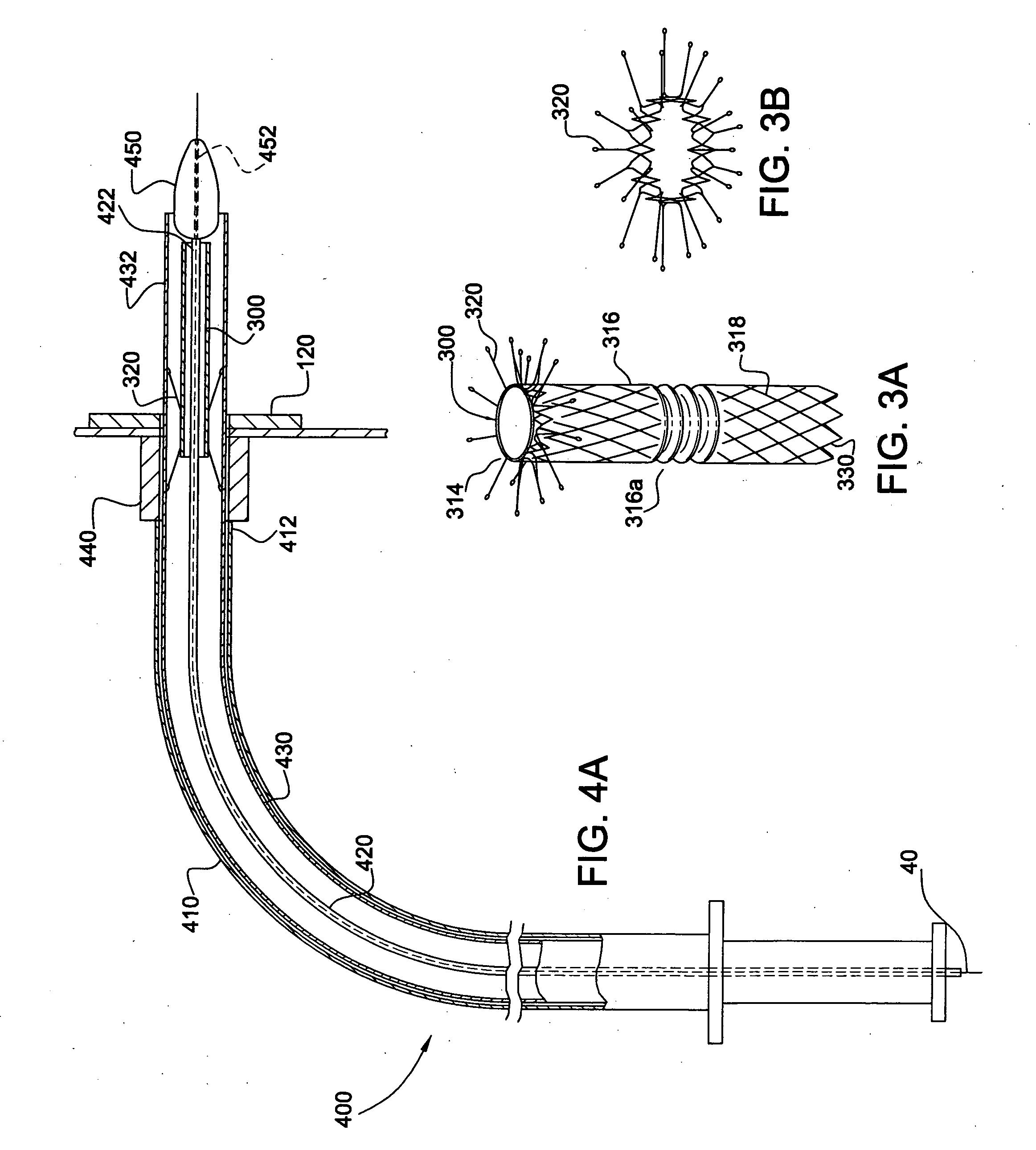 System and method for endoluminal grafting of bifurcated and branched vessels