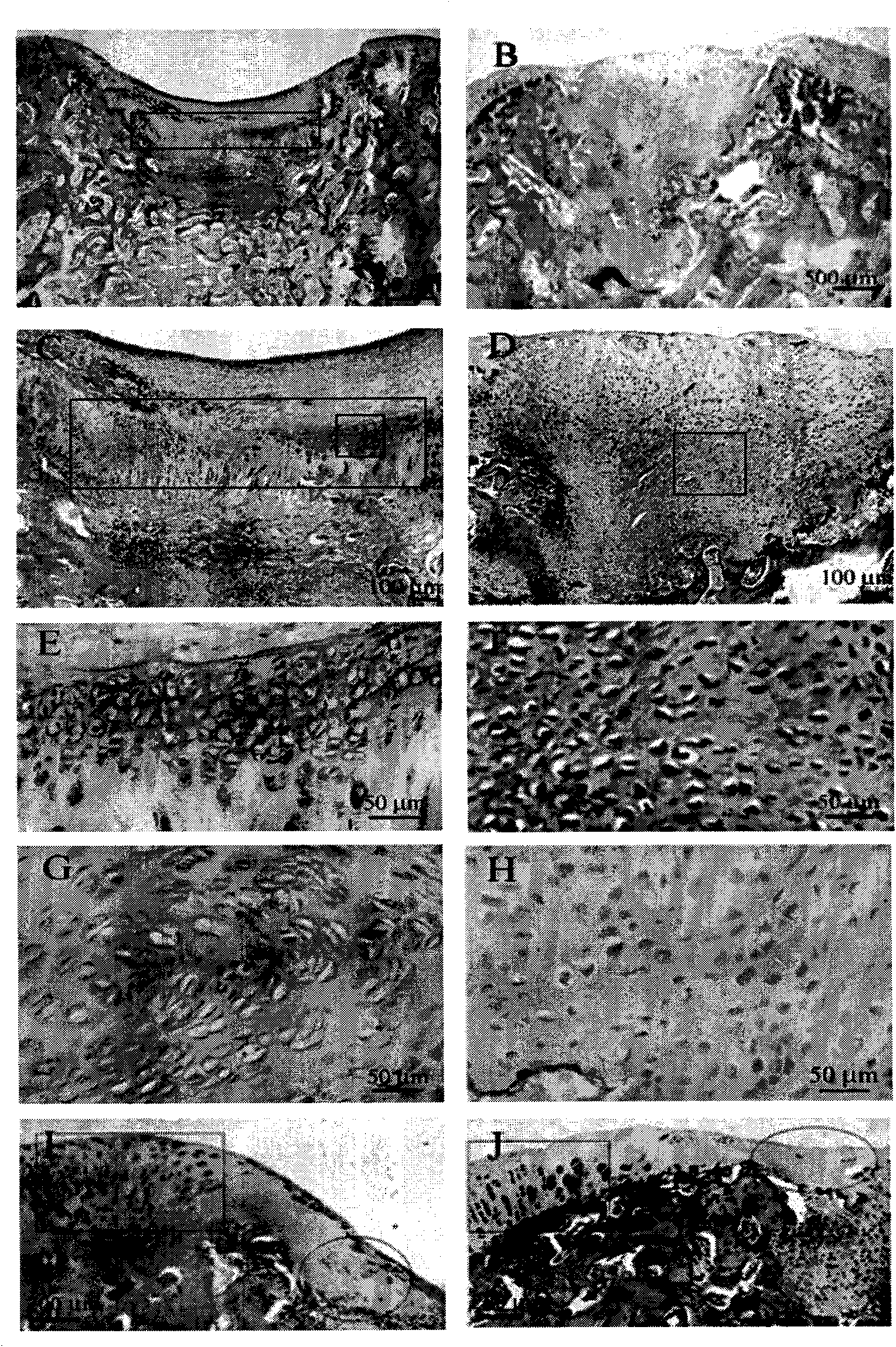 Application of midkine protein and medical device containing protein