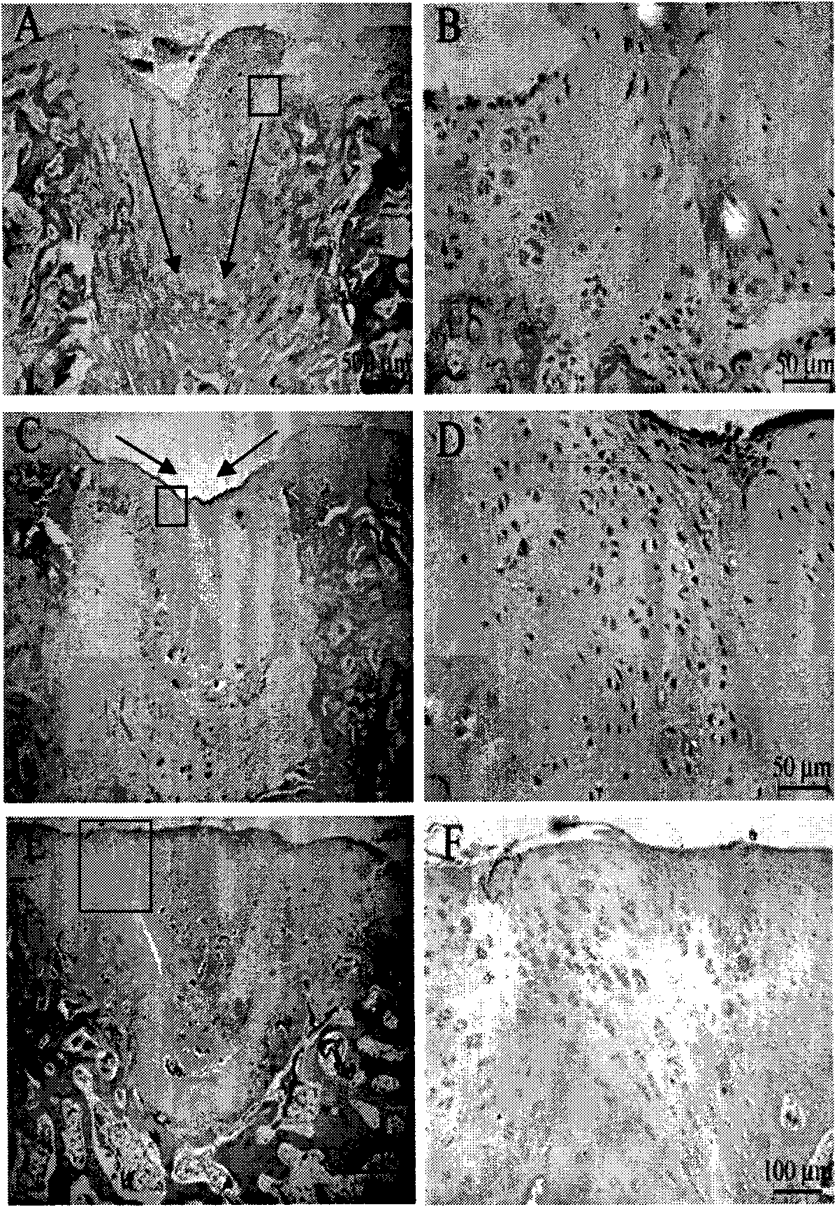 Application of midkine protein and medical device containing protein