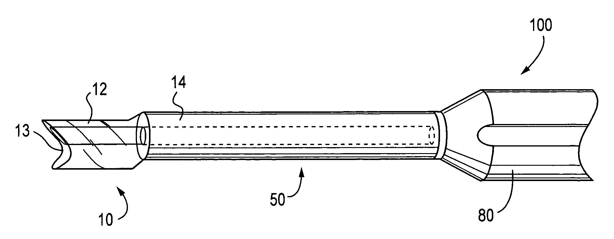 Method of using offset drill guide in arthroscopic surgery