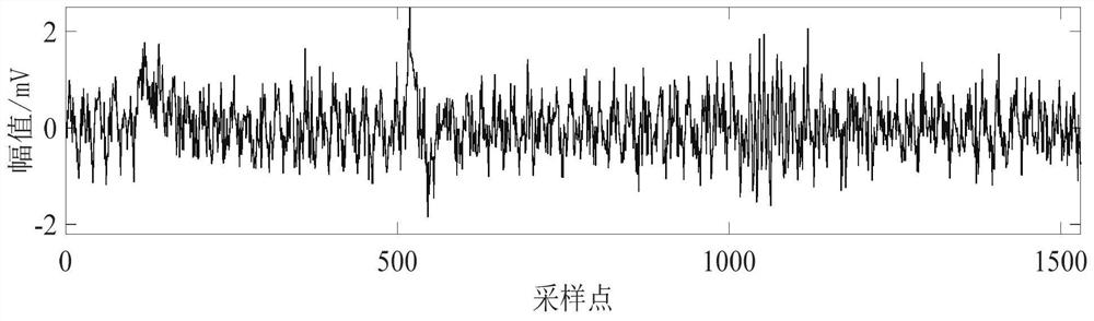 Transformer Partial Discharge UHF Signal Denoising Method Based on Improved Variational Mode and Singular Value Decomposition