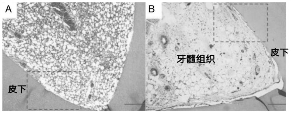 Nano-particle and gel for promoting dentin regeneration as well as preparation method and application of nano-particle and gel