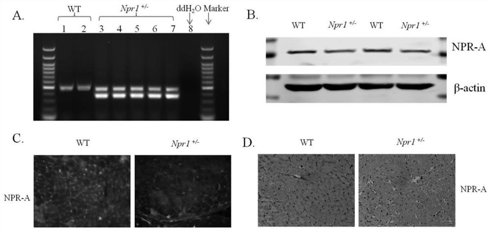 Construction method and application of animal model of dilated cardiomyopathy with cardiorenal syndrome