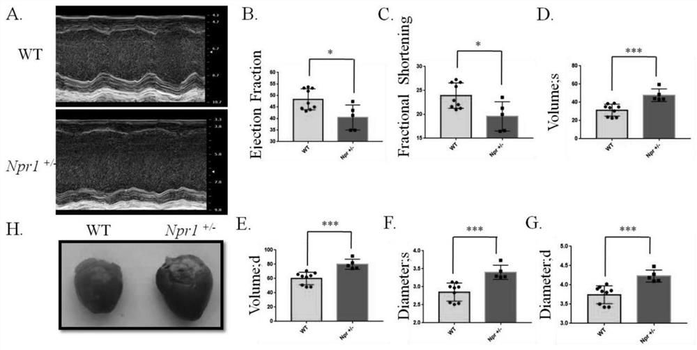 Construction method and application of animal model of dilated cardiomyopathy with cardiorenal syndrome