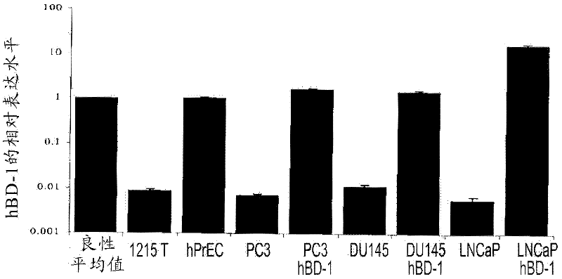 Targeting pax2 for the treatment of breast cancer