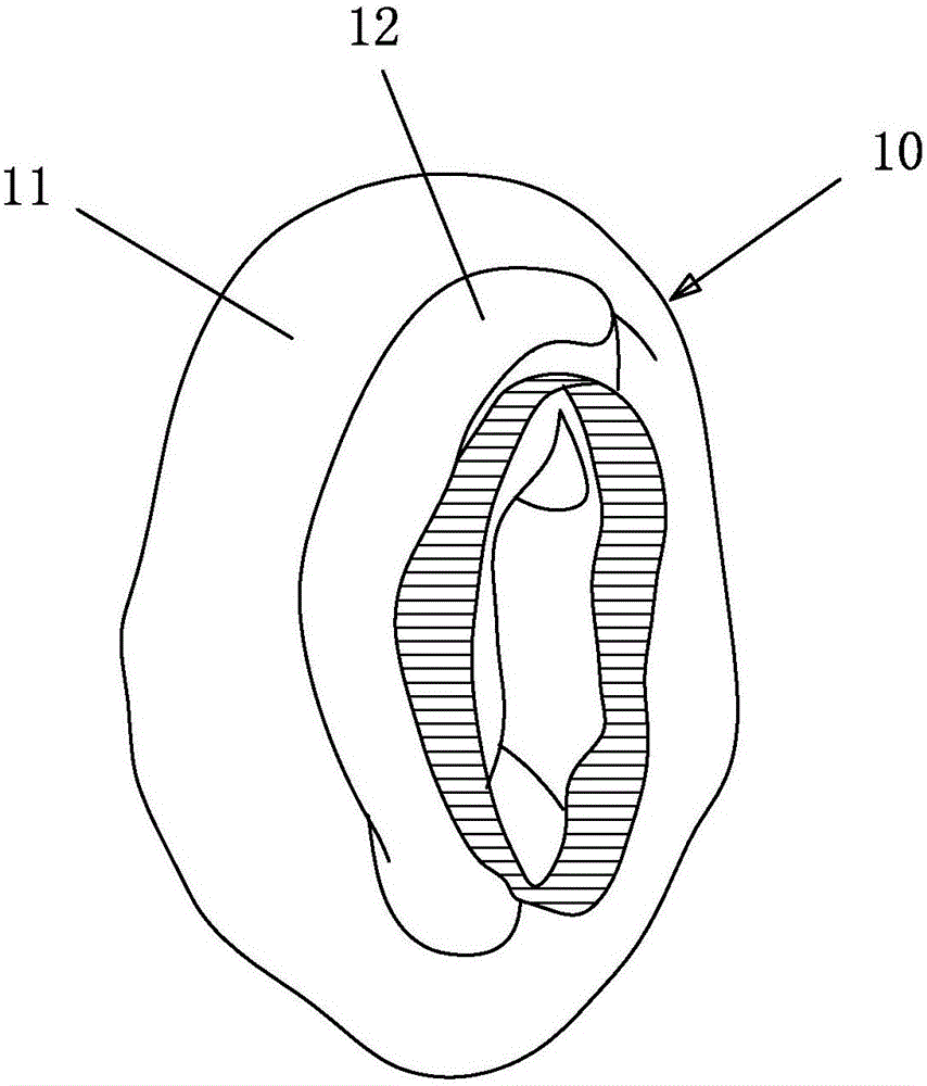 Newborn auricle orthosis and manufacturing method thereof