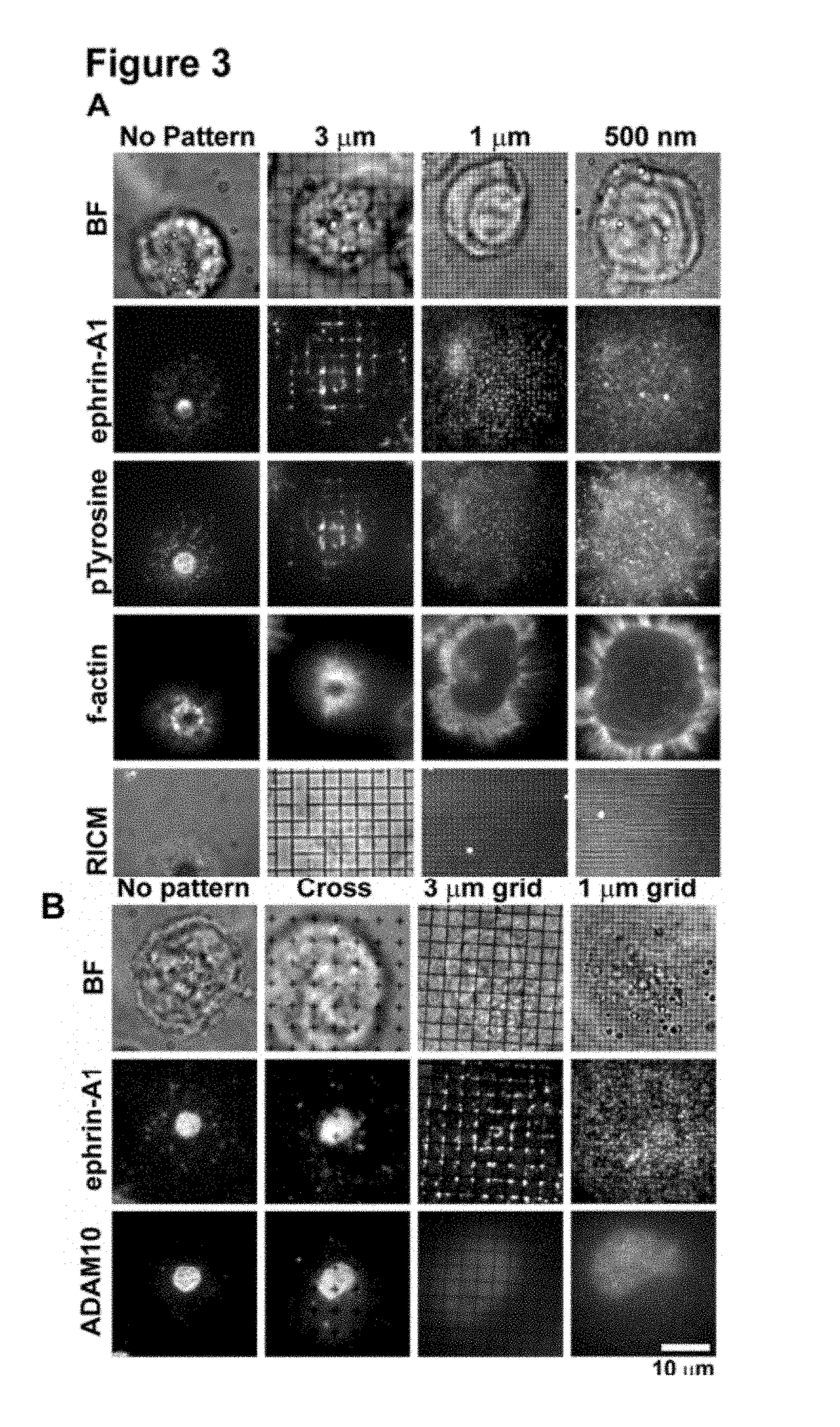 Spatial biomarker of disease and detection of spatial organization of cellular receptors