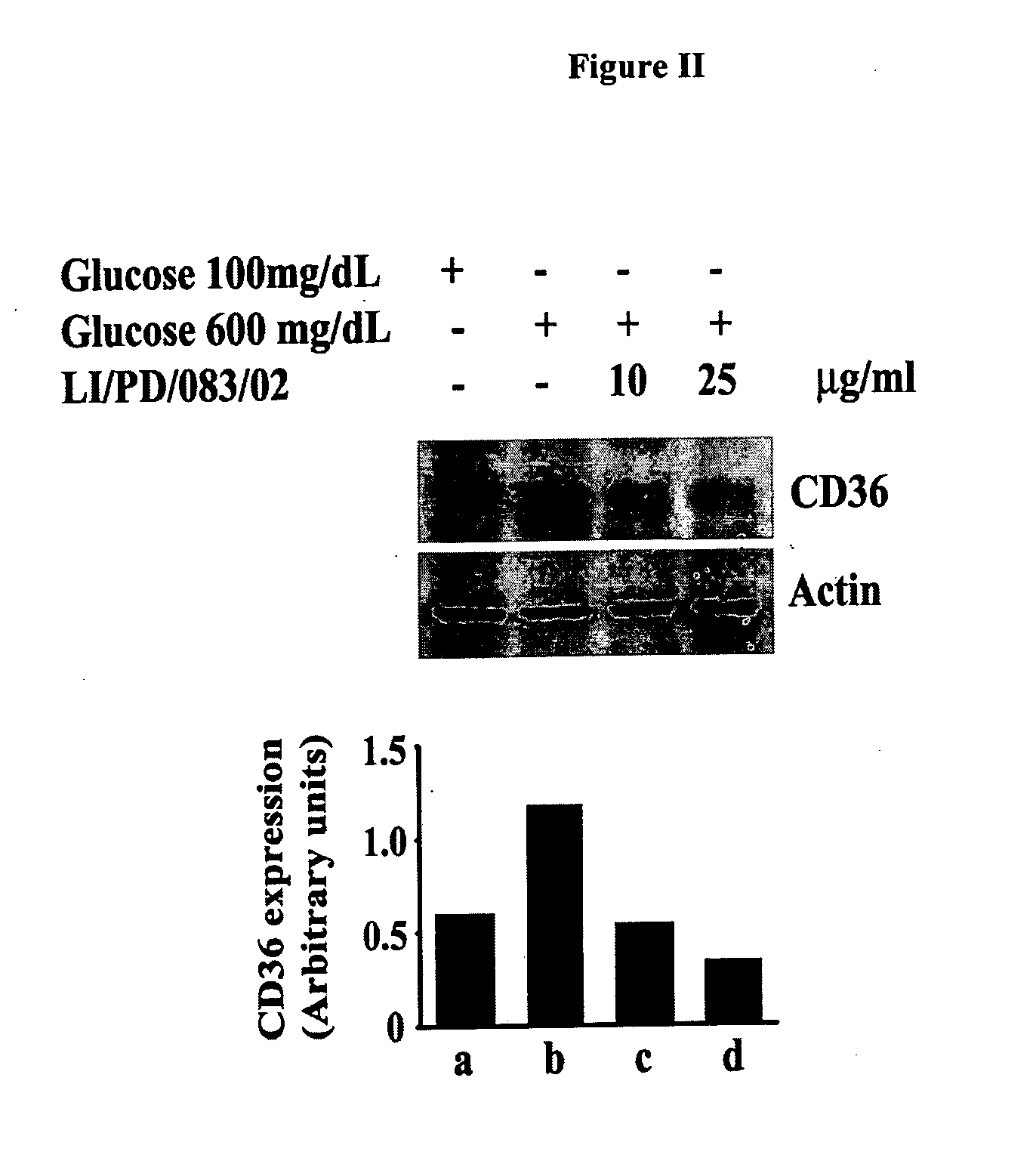 Agents derived from holoptelea integrifolia and their compositions for the control of metabolic syndrome and associated diseases