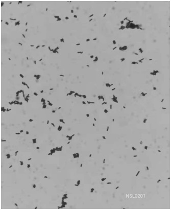 A strain of animal bifidobacterium nsy0201 and its application in the preparation of health products or medicines for enhancing body immunity