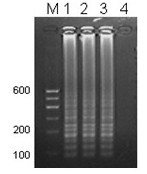 Aflatoxin detection reagent kit based on loop-mediated isothermal gene amplification method
