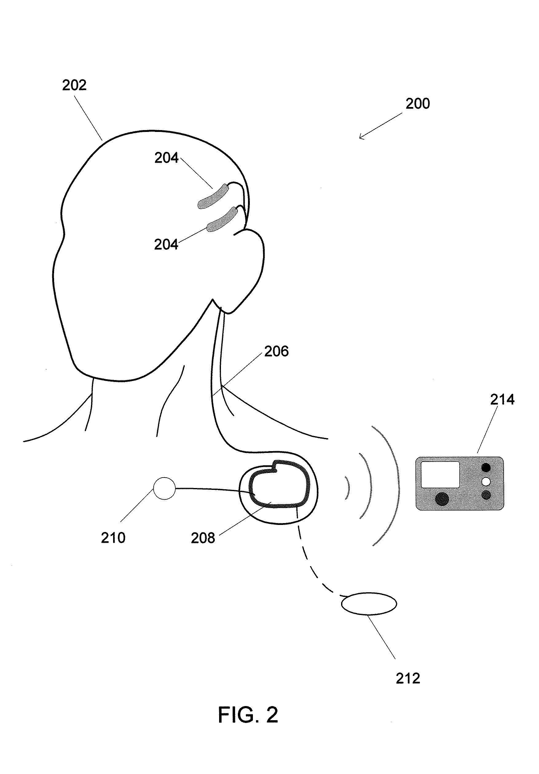 Systems and Method for Recording Clinical Manifestations of a Seizure