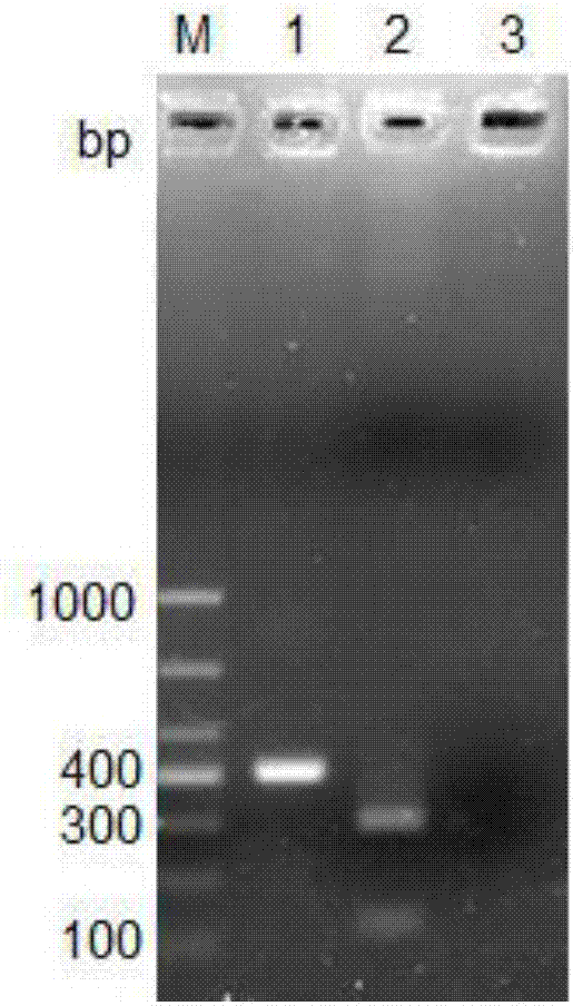 Salmonella Indiana PCR (polymerase chain reaction) detection kit and non-diagnosis detection method thereof