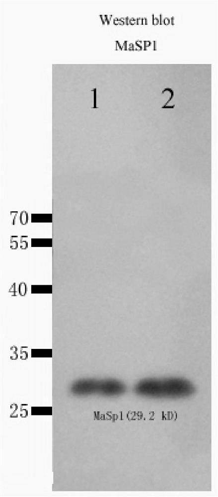 Absorbable medical suture and preparation method thereof