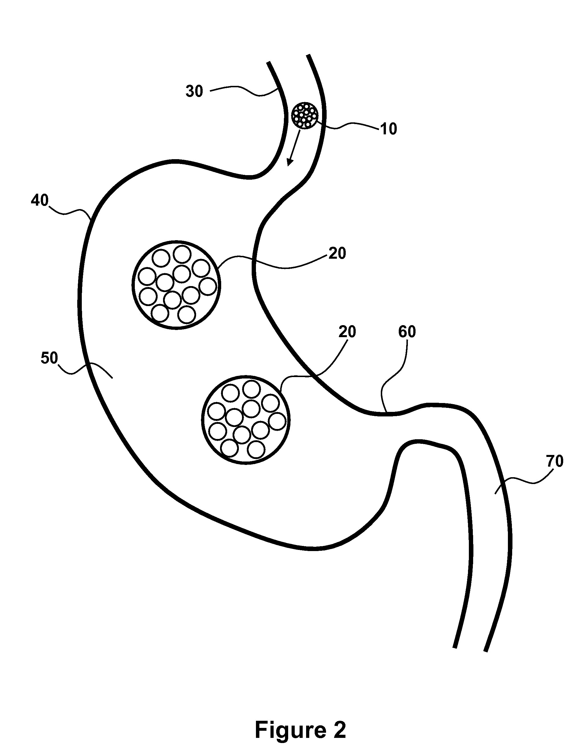Swallowable Self-Expanding Gastric Space Occupying Device