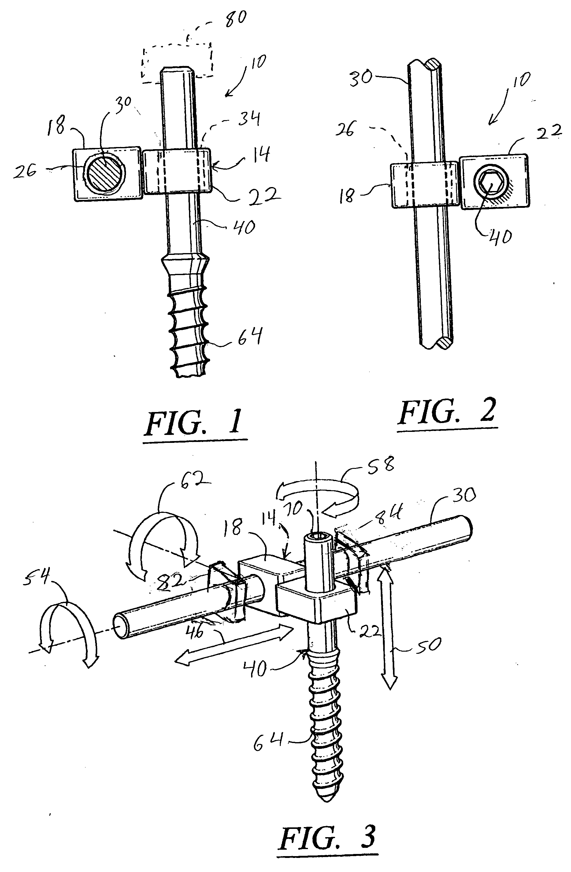 Artificial facet joint and method