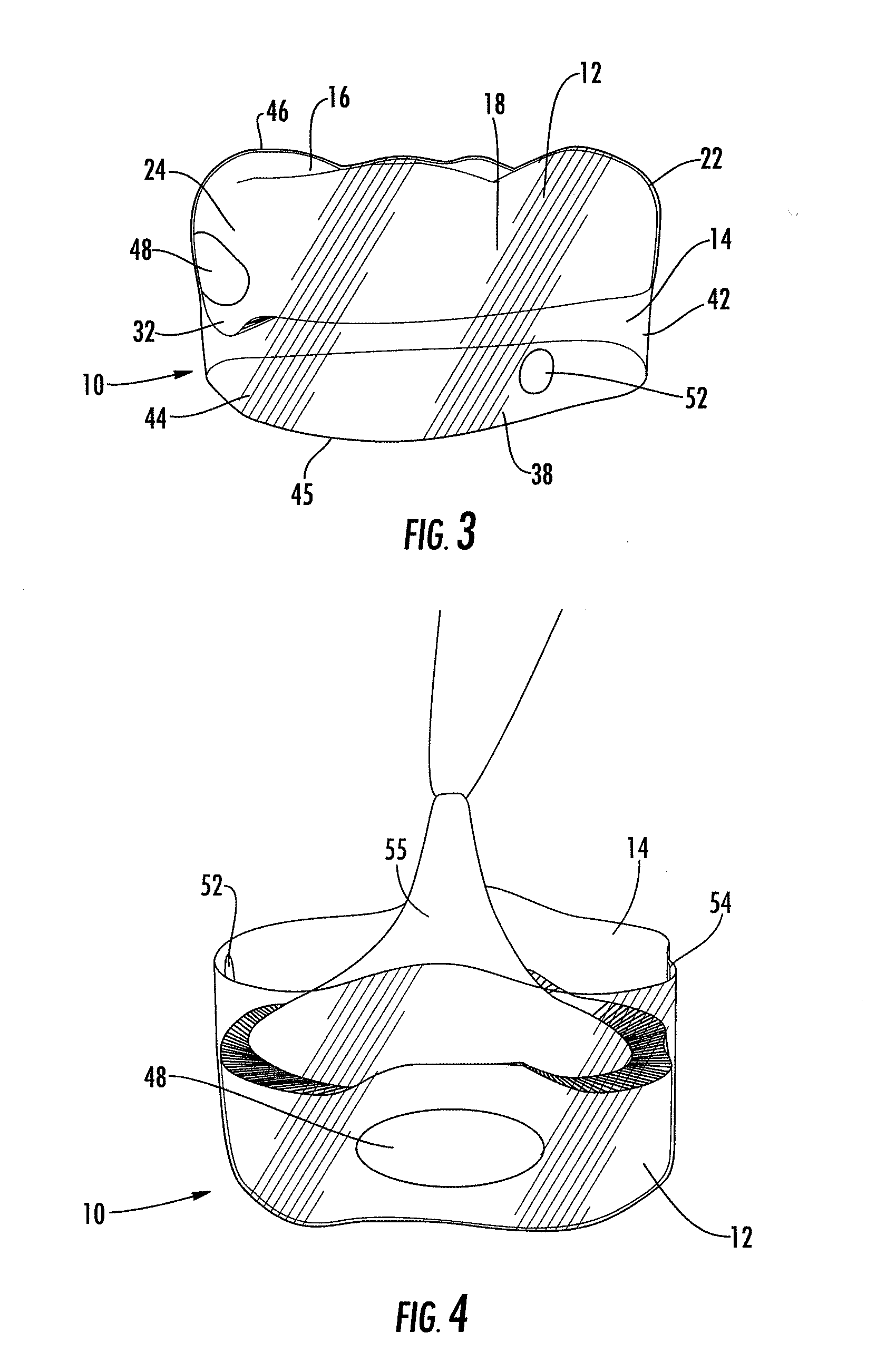 Universal dental crown and system and method of restoring a tooth using a universal dental crown