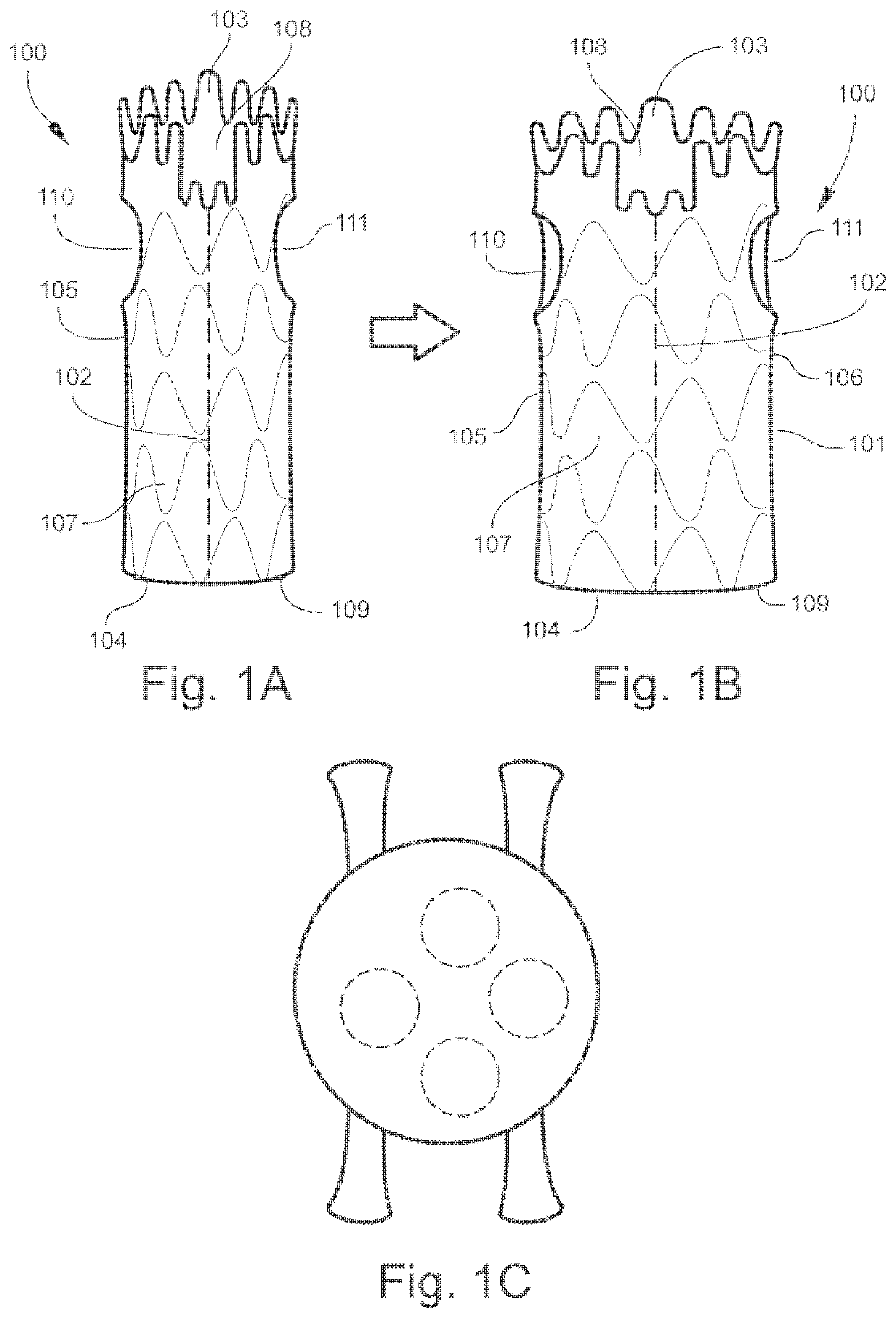 Universal endovascular grafts