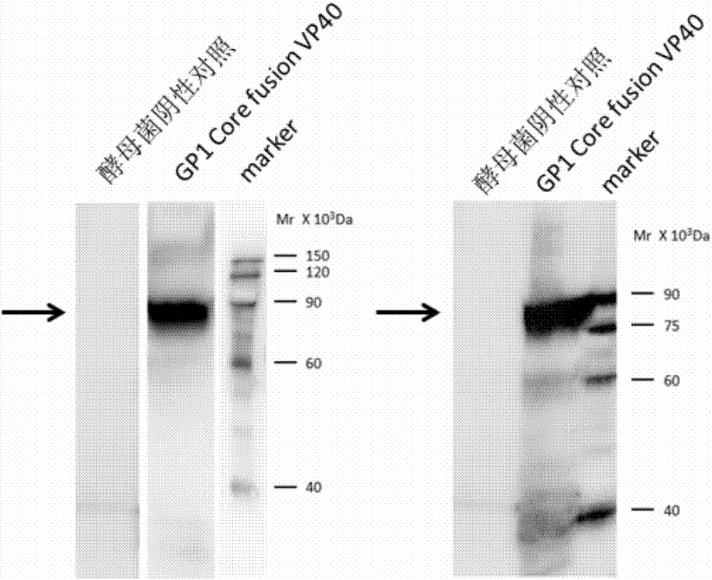 Preparation method of fusion mutant of Ebola virus glycoprotein and matrix protein
