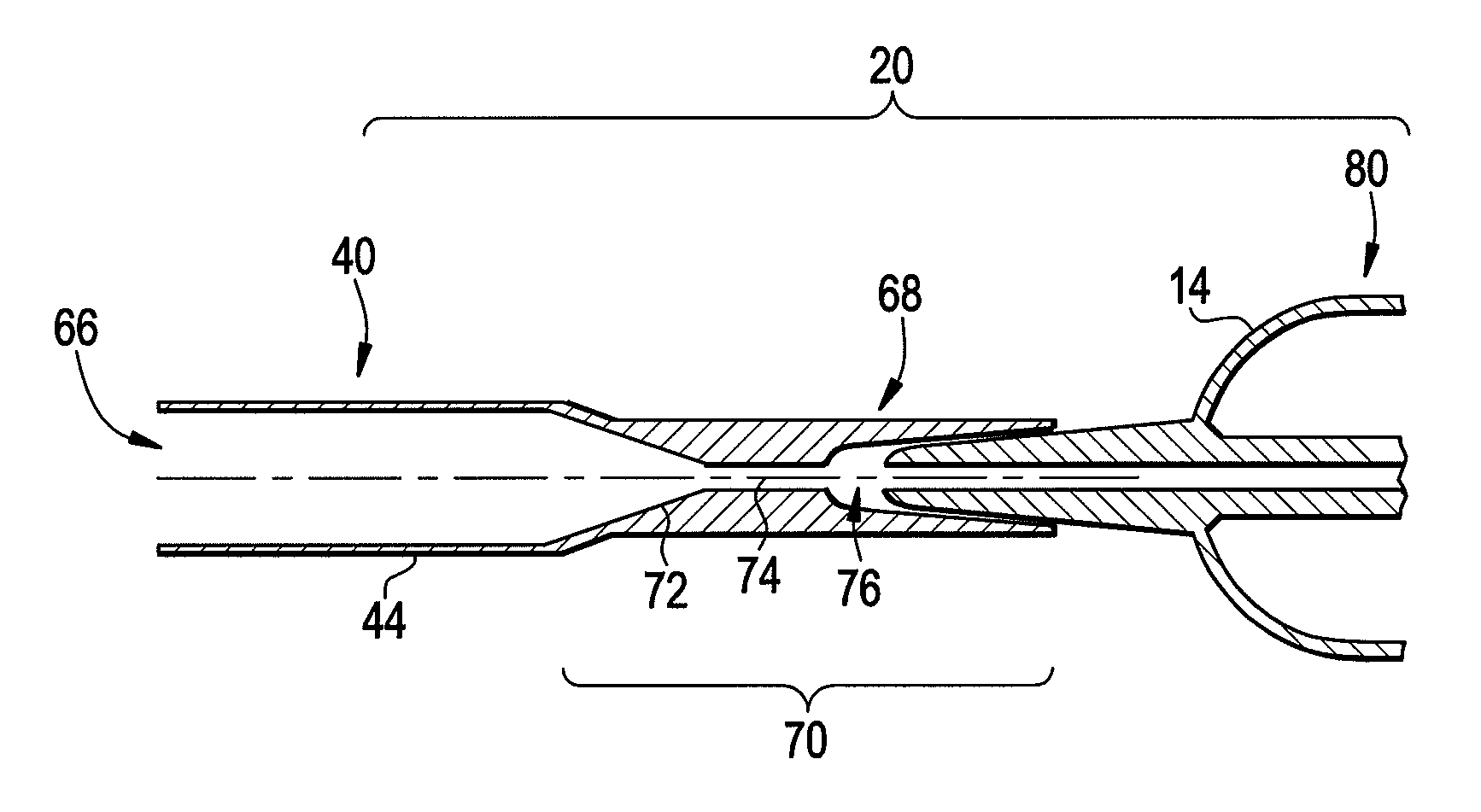 Catheter with removable filter retrieval tip