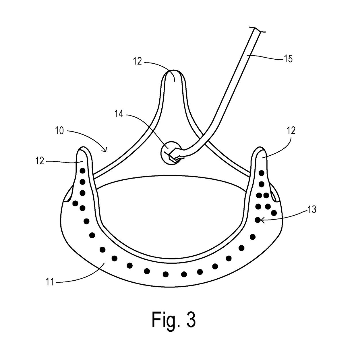 Temporary Disposable Scaffold Stand and Tools to Facilitate Reconstructive Valve Surgery