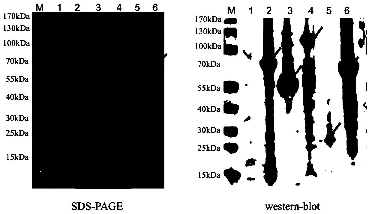 Swine streptococcicosis-Glasser's disease bivalent subunit vaccine and preparation method thereof