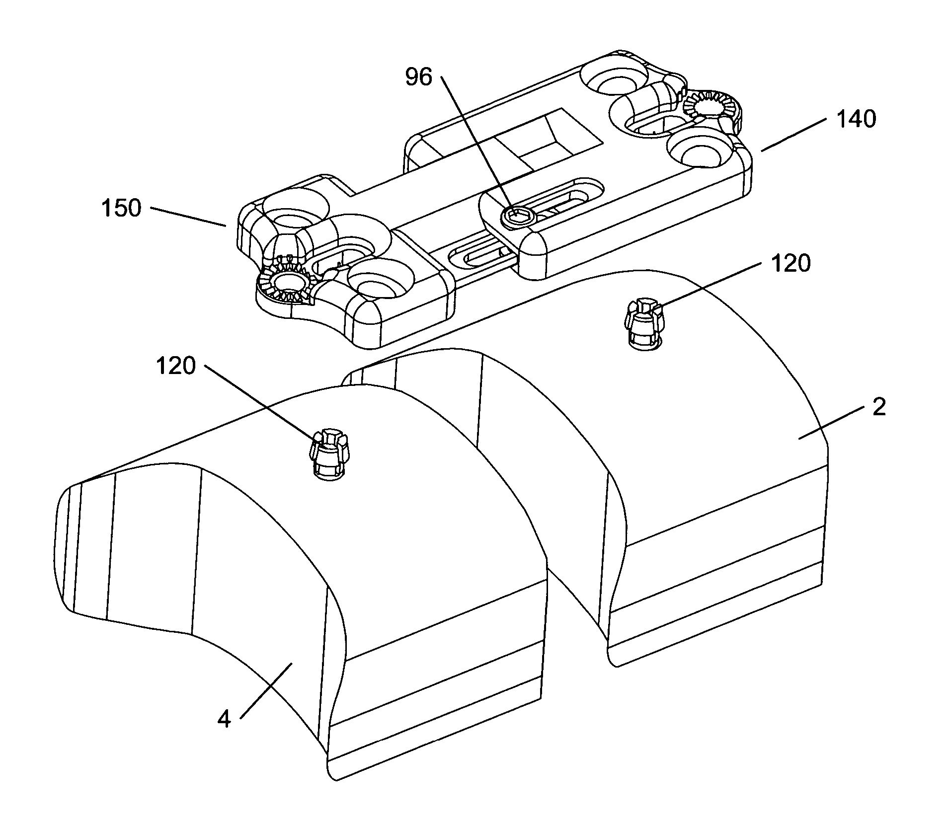 Plating system for bone fixation and subsidence and method of implantation