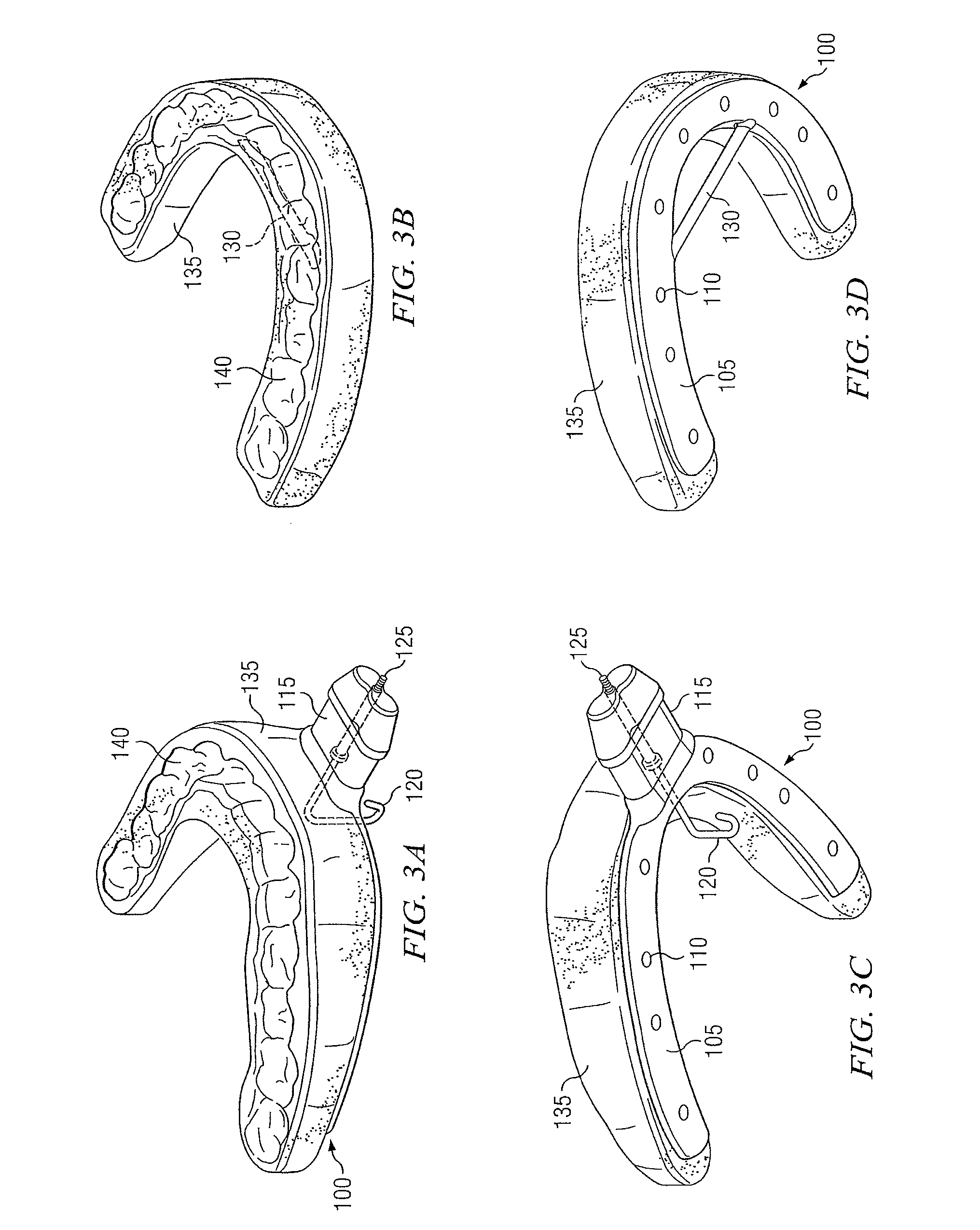 Apparatus for prevention of snoring and improved breathing