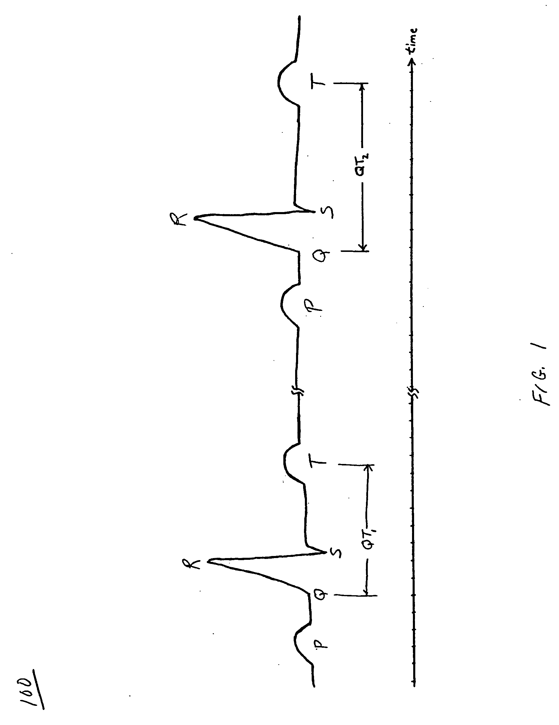 Method and system for terminating an atrial arrhythmia