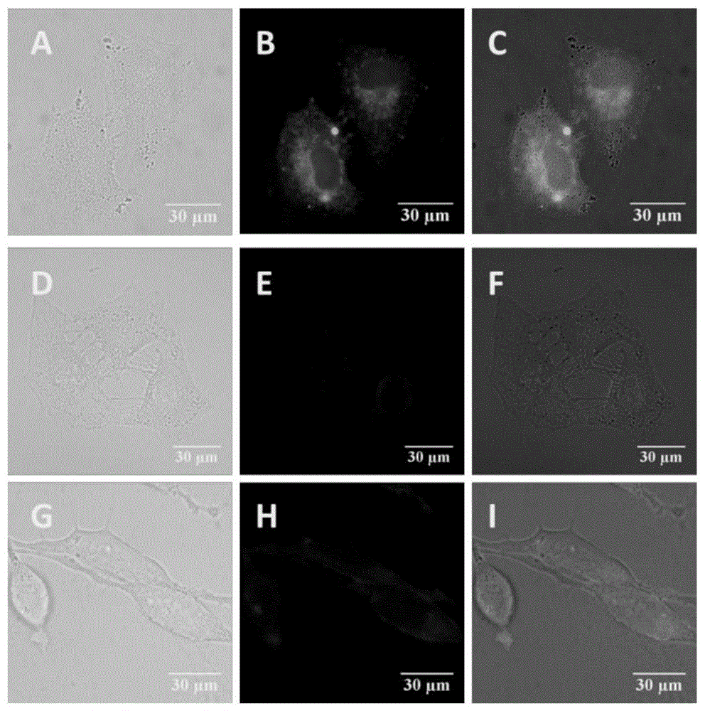 A kind of APN inhibitor with fluorescent property and its application