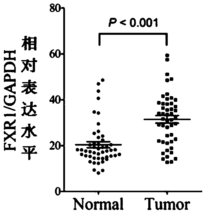 A molecular marker for esophageal cancer and uses thereof