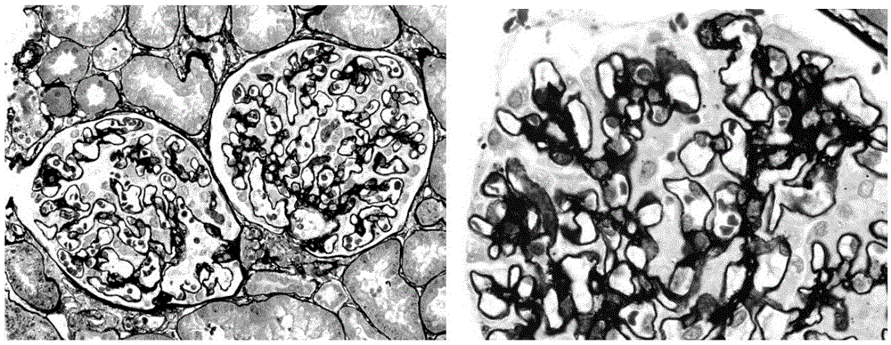 Improved Hexamine Silver Masson Overstaining Method