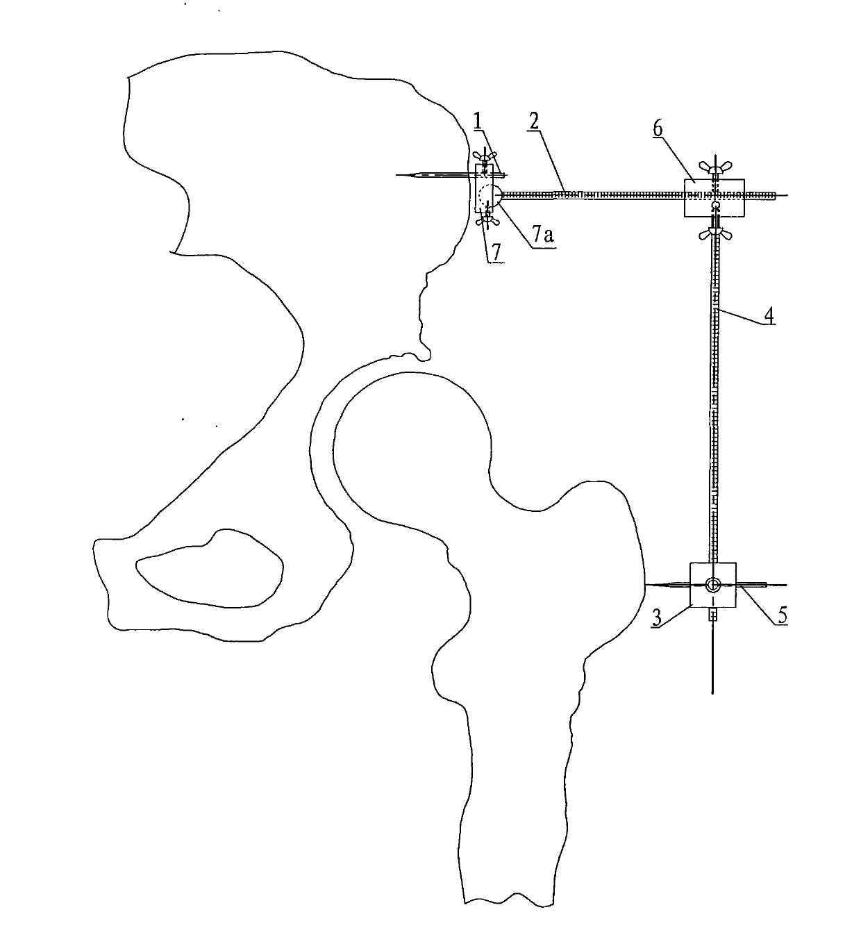 Measurer of eccentric distance of hip joint and extended limb length