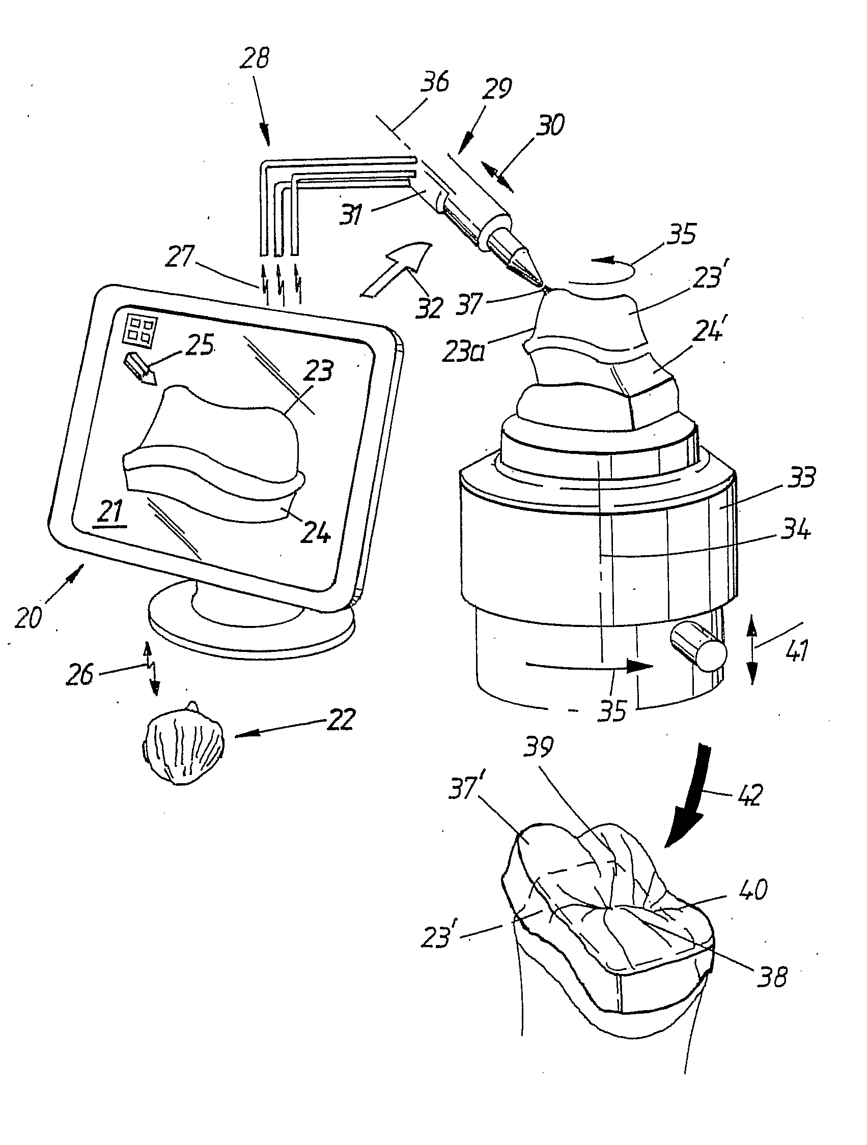 Method and System for Coloring or Tinting a Prosthesis, and Such a Prosthesis