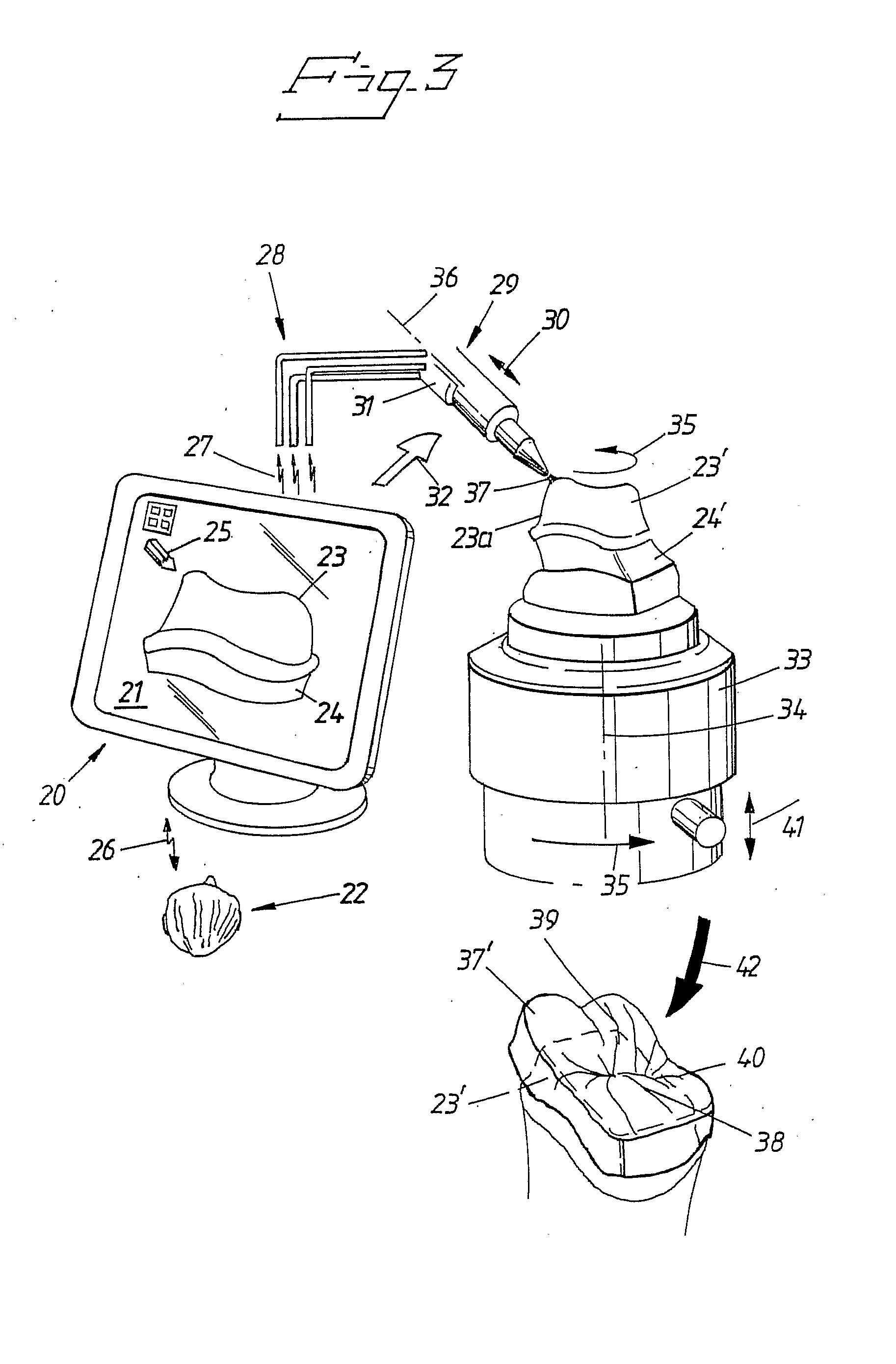 Method and System for Coloring or Tinting a Prosthesis, and Such a Prosthesis