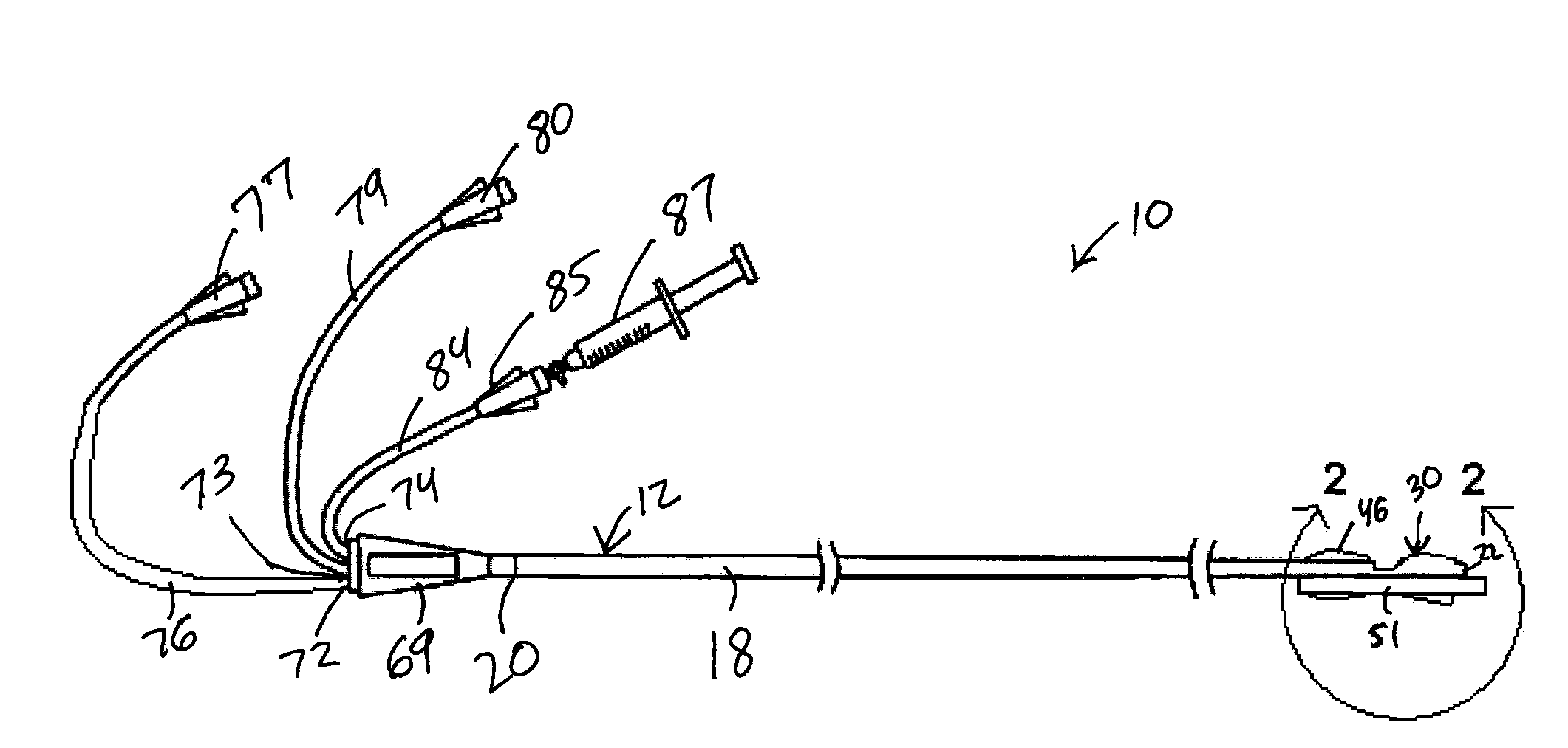 Thrombectomy and Balloon Angioplasty/Stenting Device