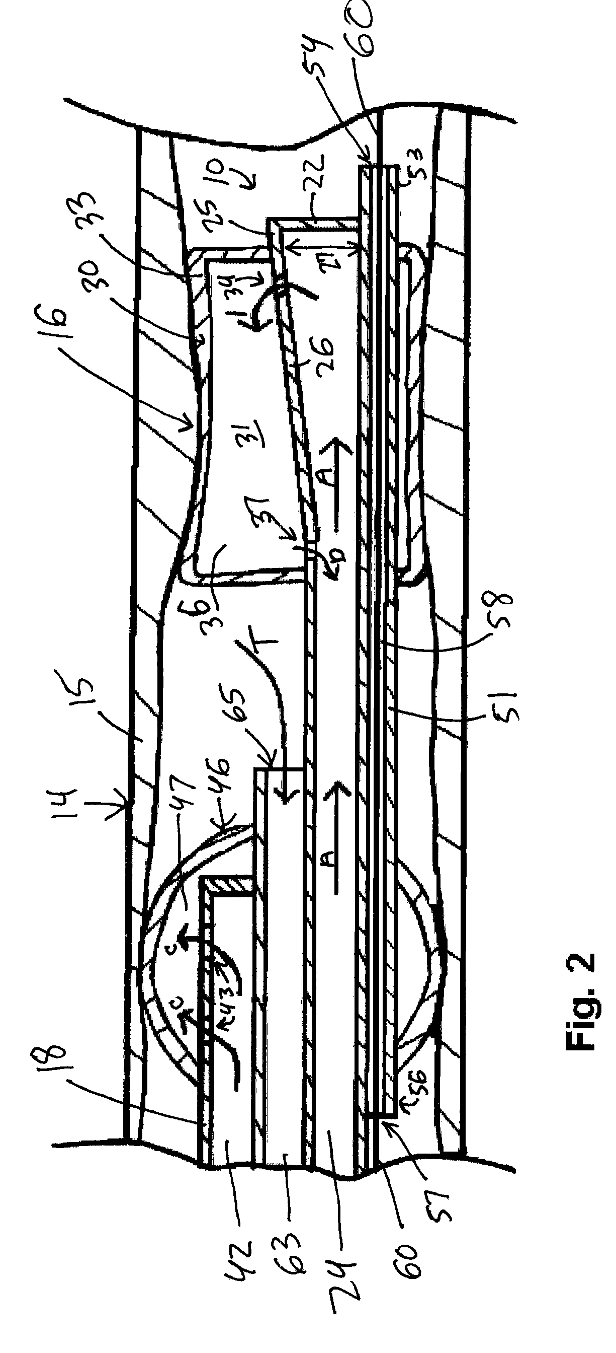 Thrombectomy and Balloon Angioplasty/Stenting Device