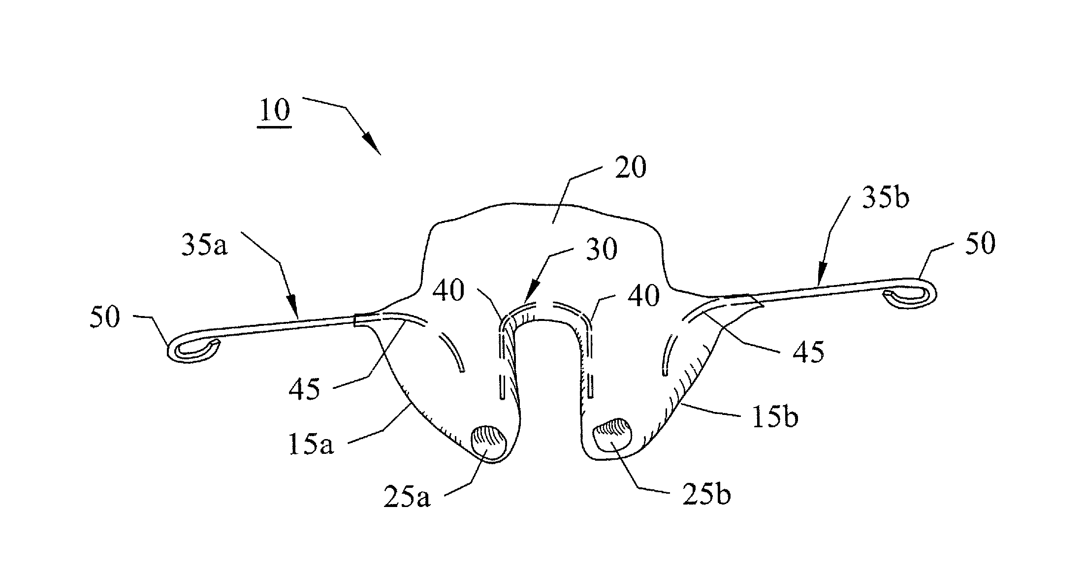 Rhinoplasty appliance and method of forming the same