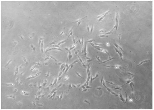 Method for preparing, culturing and purifying dental pulp mesenchymal stem cells