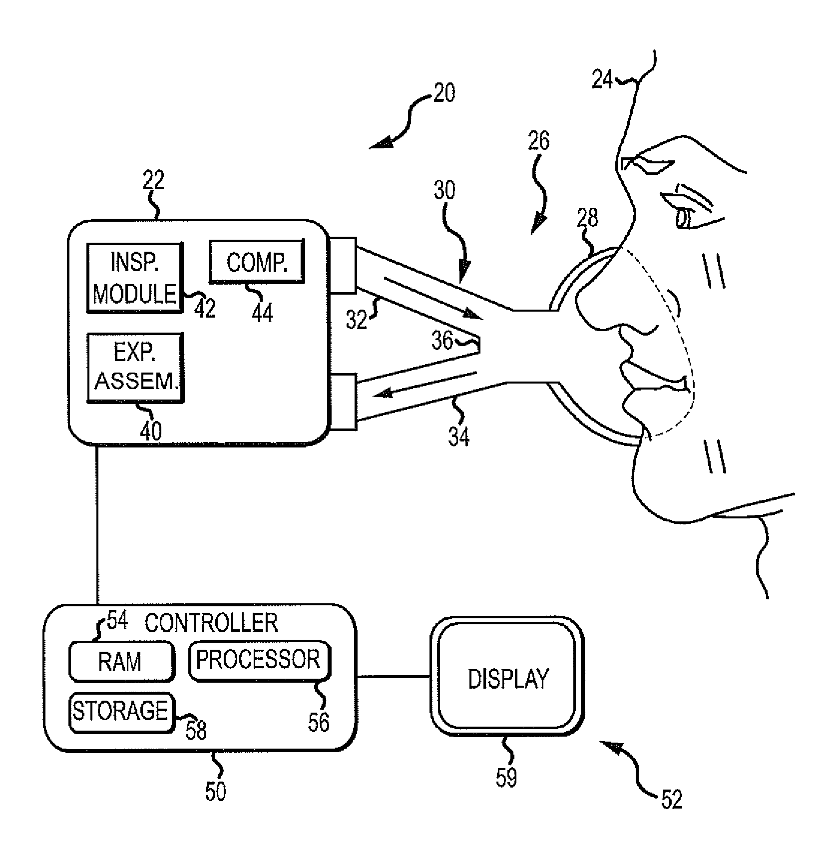 Exhalation Valve Assembly With Integral Flow Sensor