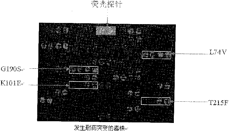 Gene chip for inspecting HIV P-reverse transcriptase inhibiting resistance and its reagent kit