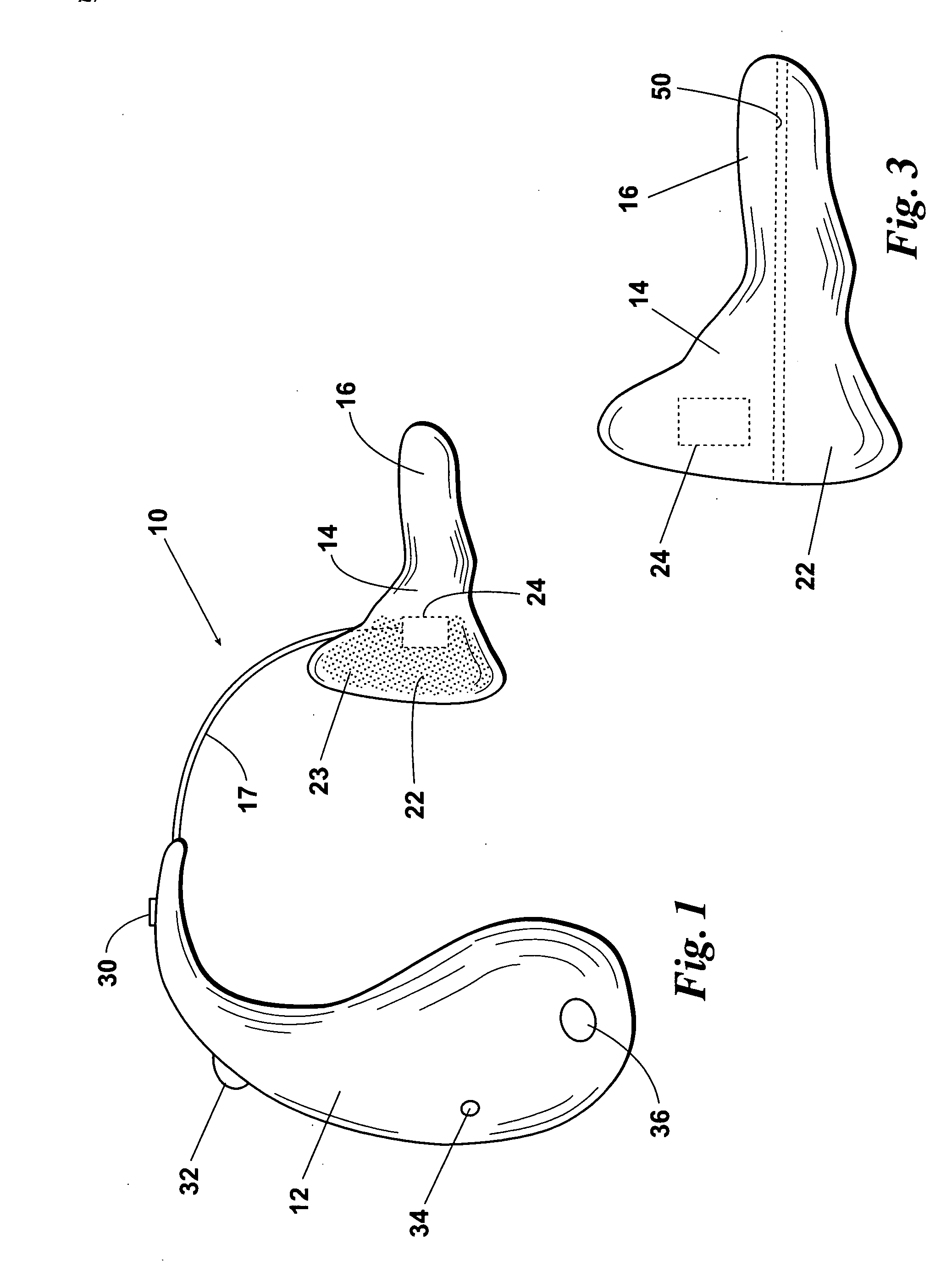 Bone conduction hearing assistance device